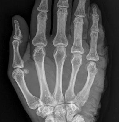 pexels-photo-35053995